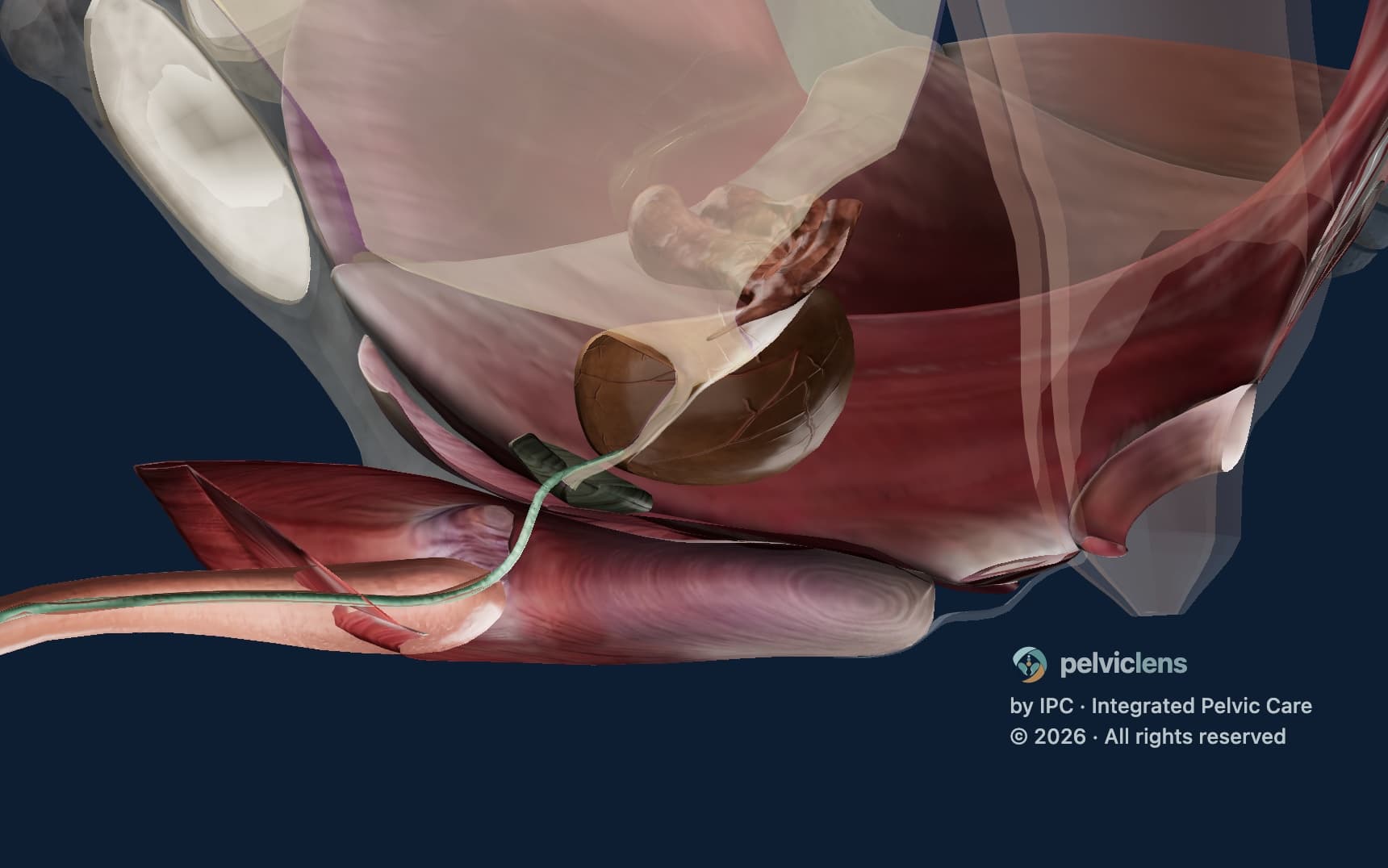 Esfínter uretral externo en las tres capas del piso pélvico, en el modelo de incontinencia de Pelvic Lens, vista de la salida