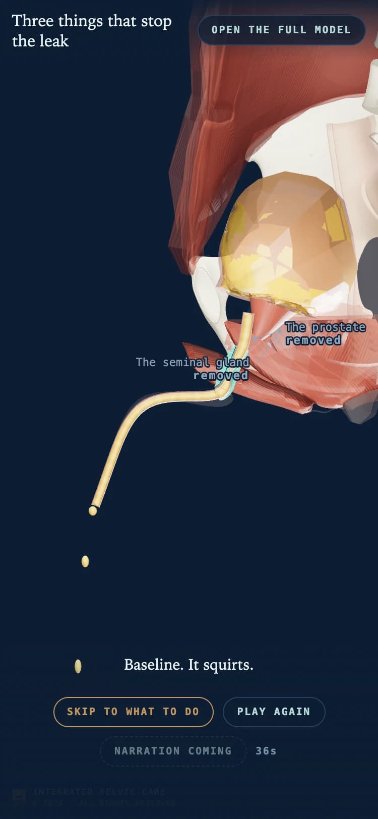 Three things that stop the leak