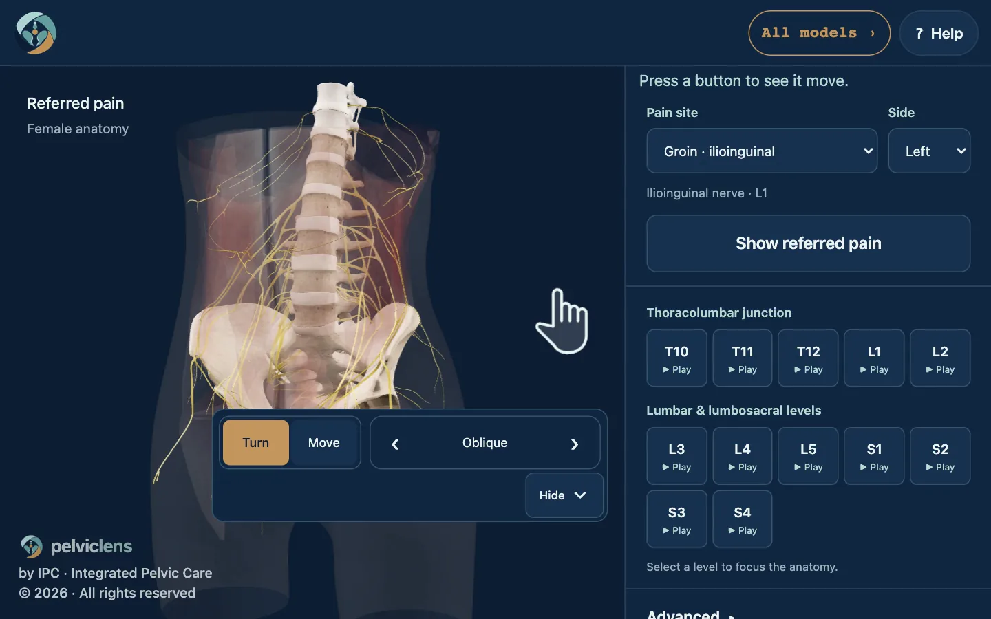 A spinal contribution, a travelling ilioinguinal signal and an illustrative groin pain response on the reviewed female anatomy.